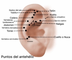 aurculoterapia